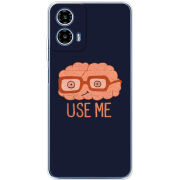 Чохол BoxFace Motorola Moto G35 