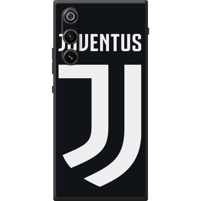 Чохол BoxFace ZTE Nubia Redmagic 10 Air FC J