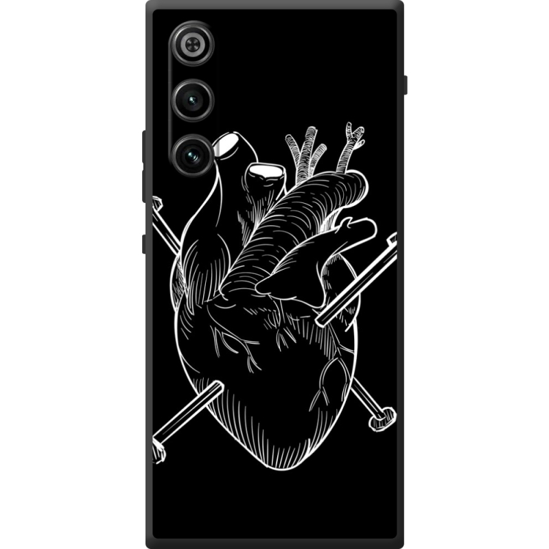 Чохол BoxFace ZTE Nubia Redmagic 10 Air 