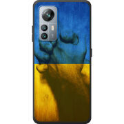 Чохол BoxFace Blackview A85 Handshake