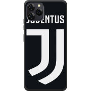 Чохол BoxFace Blackview A95 FC J