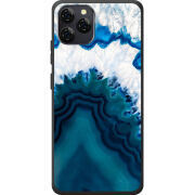 Чохол BoxFace Blackview A95 