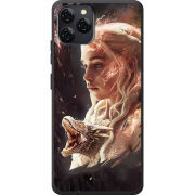 Чохол BoxFace Blackview A95 