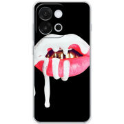 Чохол BoxFace OnePlus 13T 