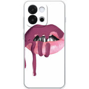 Чохол BoxFace OnePlus 13T 