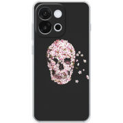 Чохол BoxFace OnePlus 13T 