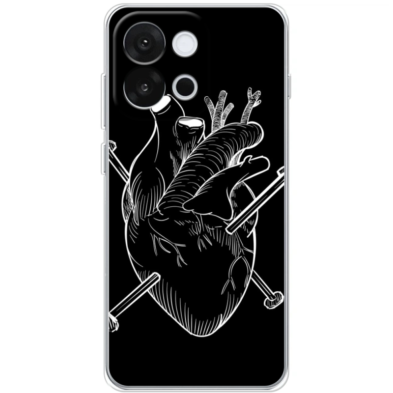 Чохол BoxFace OnePlus 13T 