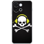 Чохол BoxFace OnePlus 13T 