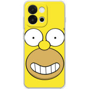 Чохол BoxFace OnePlus 13T 