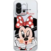 Прозорий чохол BoxFace OnePlus 13T Lady M