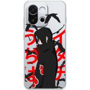 Прозорий чохол BoxFace OnePlus 13T Учиха Итачи