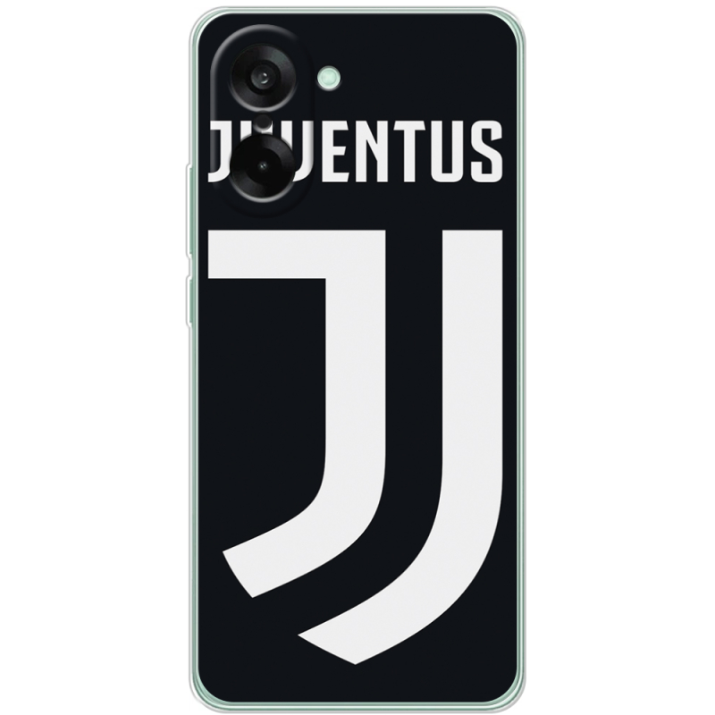 Чохол BoxFace OnePlus Ace 5 Racing FC J