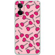 Чохол BoxFace OnePlus Ace 5 Racing 