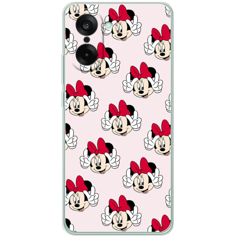 Чохол BoxFace OnePlus Ace 5 Racing 