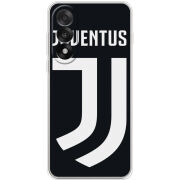 Чохол BoxFace OnePlus Ace 5 Ultra FC J