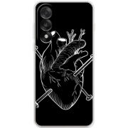 Чохол BoxFace OnePlus Ace 5 Ultra 