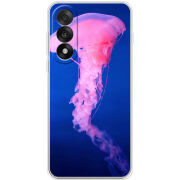 Чохол BoxFace OnePlus Ace 5 Ultra 