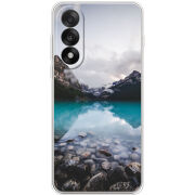 Чохол BoxFace OnePlus Ace 5 Ultra 