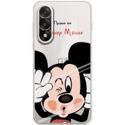 Прозорий чохол BoxFace OnePlus Ace 5 Ultra Mister M