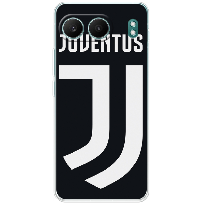 Чохол BoxFace OnePlus Nord 4 FC J