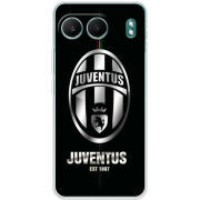 Чохол BoxFace OnePlus Nord 4 