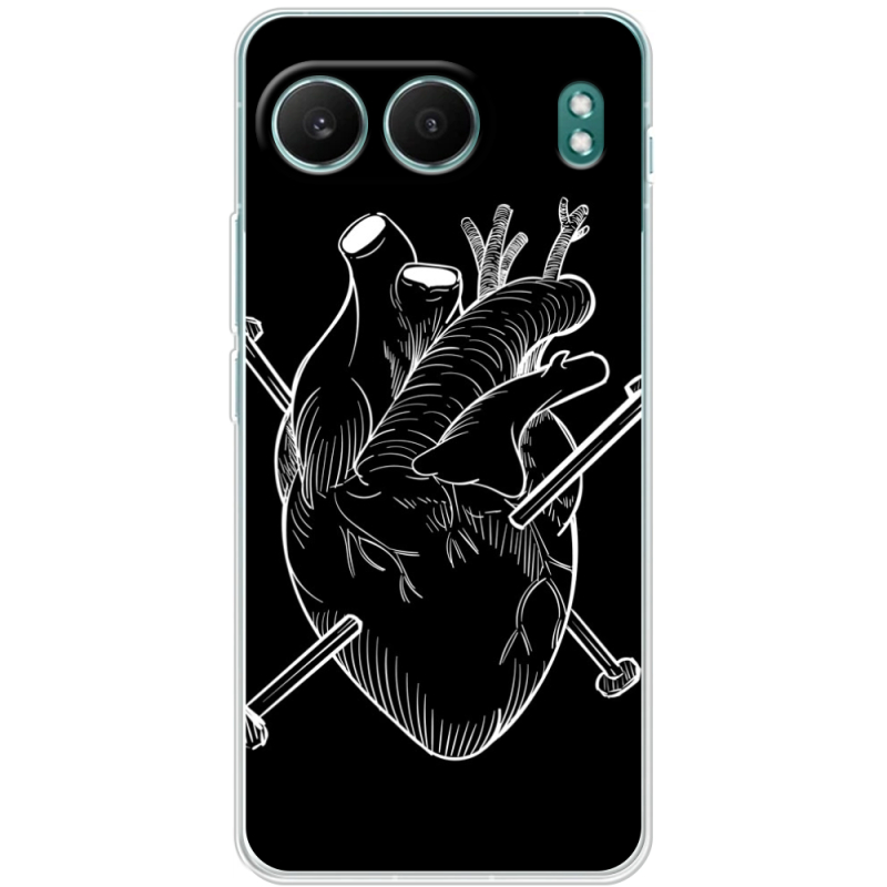 Чохол BoxFace OnePlus Nord 4 