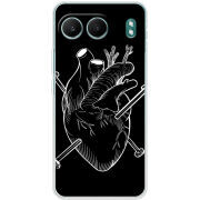 Чохол BoxFace OnePlus Nord 4 