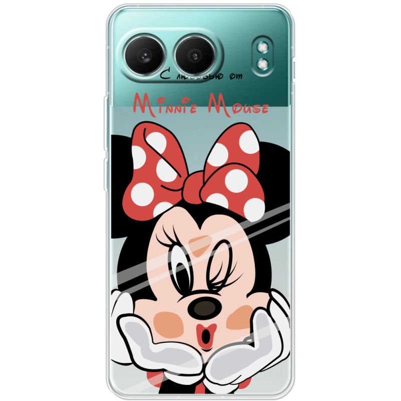 Прозорий чохол BoxFace OnePlus Nord 4 Lady M