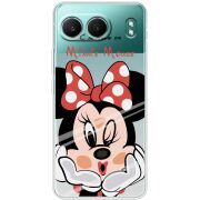 Прозорий чохол BoxFace OnePlus Nord 4 Lady M