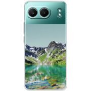 Прозорий чохол BoxFace OnePlus Nord 4 Green Mountain