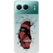 Прозорий чохол BoxFace OnePlus Nord 4 Нападение Титана