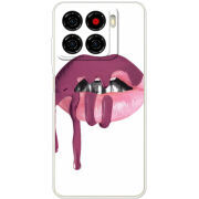 Чохол BoxFace ZTE Blade A56 