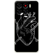 Чохол BoxFace ZTE Blade A56 