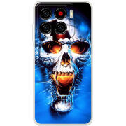 Чохол BoxFace ZTE Blade A56 