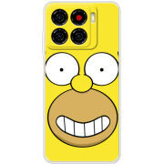 Чохол BoxFace ZTE Blade A56 