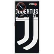 Чохол BoxFace Nubia Z70 Ultra FC J