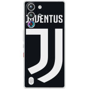 Чохол BoxFace Nubia RedMagic 10 Pro FC J