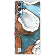 Чохол BoxFace Nubia RedMagic 10 Pro 