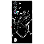 Чохол BoxFace Nubia RedMagic 10 Pro 