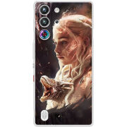 Чохол BoxFace Nubia RedMagic 10 Pro 