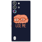 Чохол BoxFace Nubia RedMagic 10 Pro 