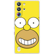 Чохол BoxFace Nubia RedMagic 10 Pro 