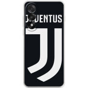 Чохол BoxFace OnePlus Nord 5 FC J