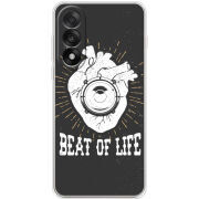 Чохол BoxFace OnePlus Nord 5 