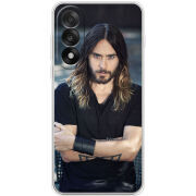 Чохол BoxFace OnePlus Nord 5 