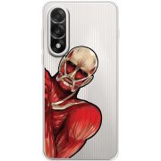 Прозорий чохол BoxFace OnePlus Nord 5 Титан