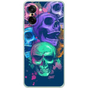 Чохол BoxFace OnePlus Nord CE5 