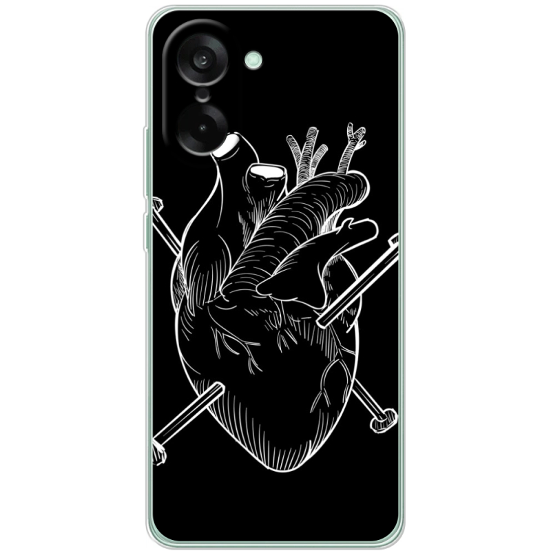 Чохол BoxFace OnePlus Nord CE5 