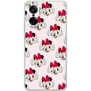 Чохол BoxFace OnePlus Nord CE5 