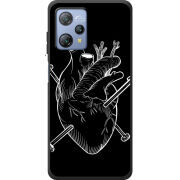 Чохол BoxFace Blackview A53 